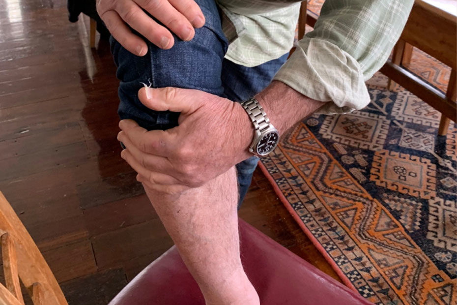 6months On -man showing his healed leg