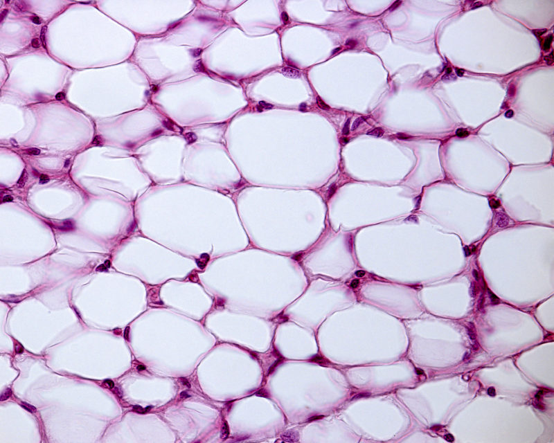 Micrograph of White Adipose Tissue in Lipoedema