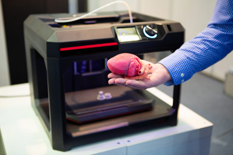 A Hand Holds a Heart Printed on a 3D Printer. Vascular Surgery.