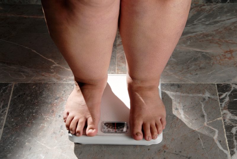 Obesity Being Overweight. Woman Standing on Scales Showing Heavy Legs from the Knees Down.