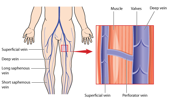 Illustration of Body, Leg,Veins,Deep,And,Superficial,Veins
