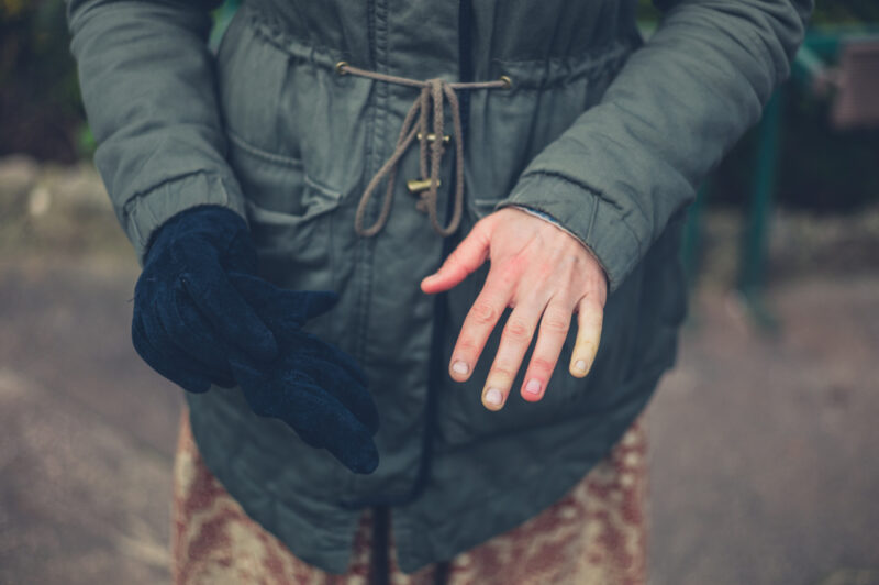 A,Young,Woman,With,Raynaud,Is,Showing,Her,Cold,Hand,Numb,Fingers,Vascular,Condition.
